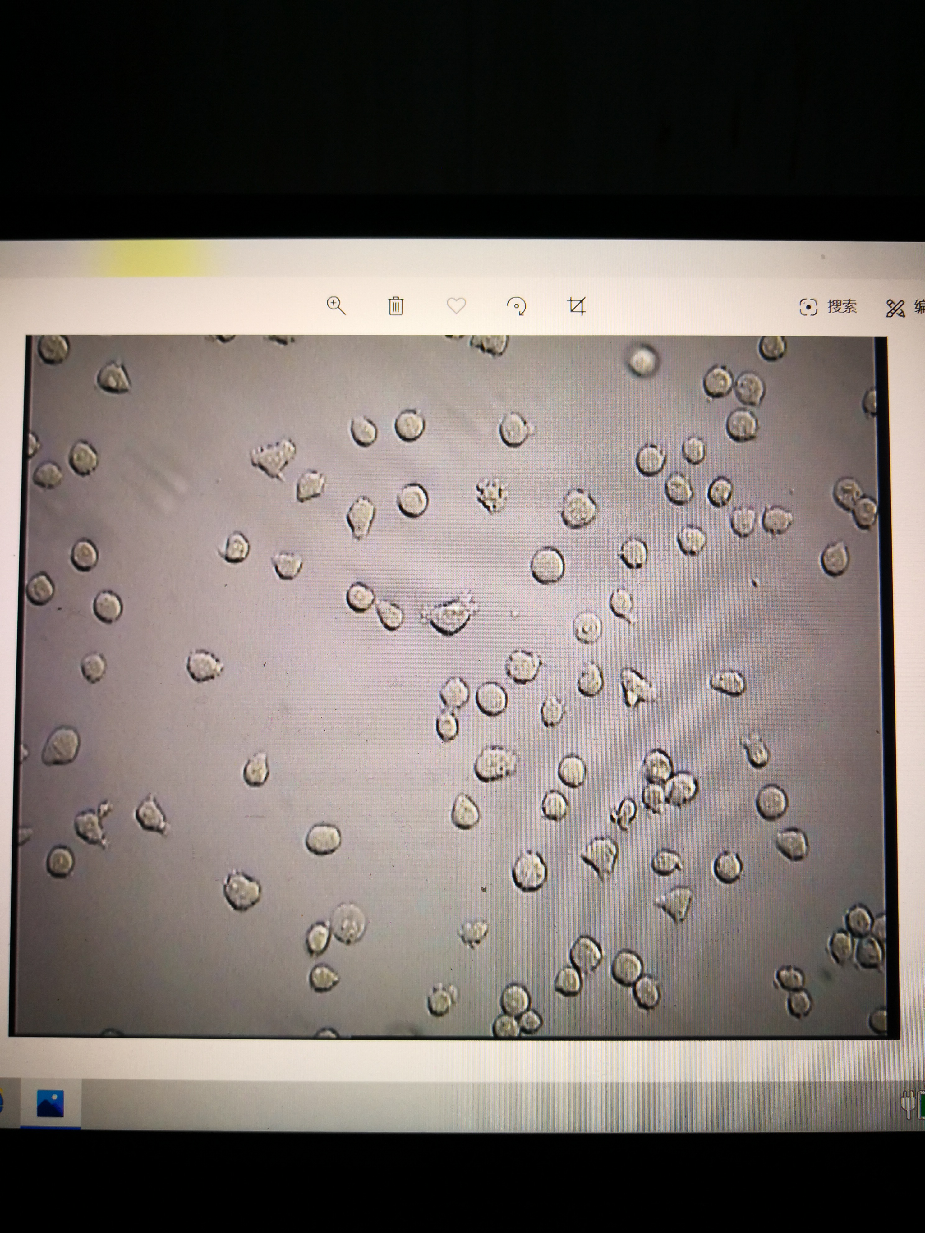 thp1传代后生长慢复苏后细胞状态差碎片特别多