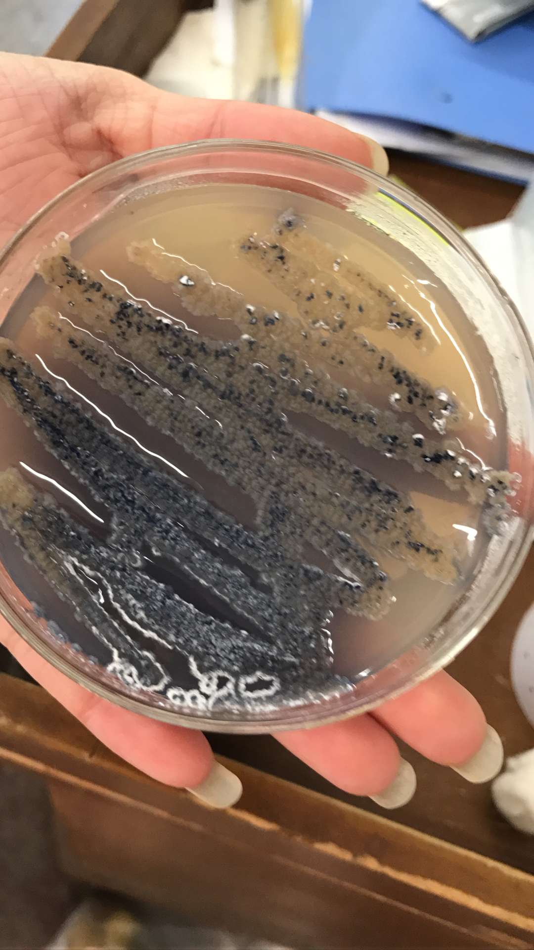 59695单bncc336594天蓝色链霉菌streptomycescoelicolorm