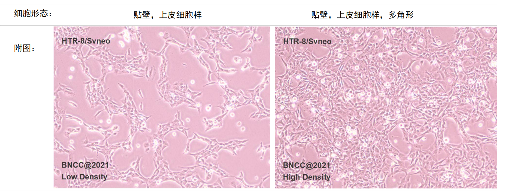 htr8svneo人绒毛膜滋养层细胞培养信息以及形态图