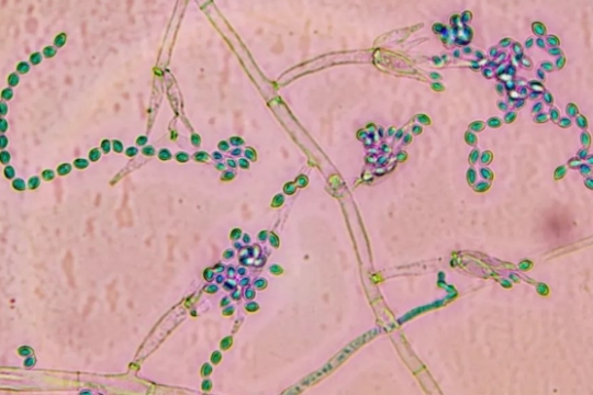 淡紫拟青霉的生物防治机制