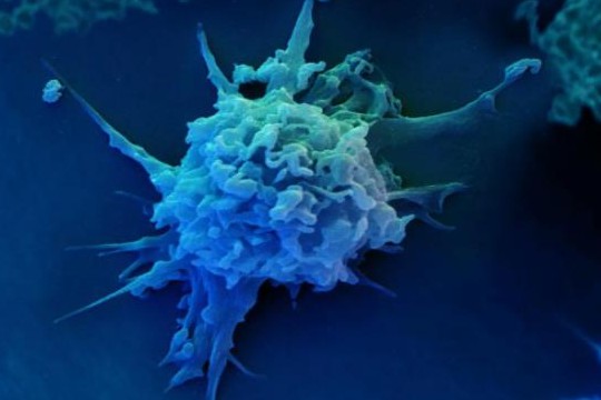 研究强调与结肠癌相关毒素相关的细菌化合物和基因的未发现潜力