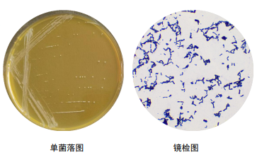 青春双歧杆菌bncc185973 菌种服务