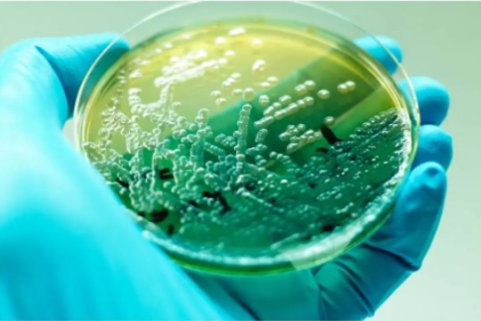 假单胞菌混合菌膜形成对毒力基因表达的影响（二）