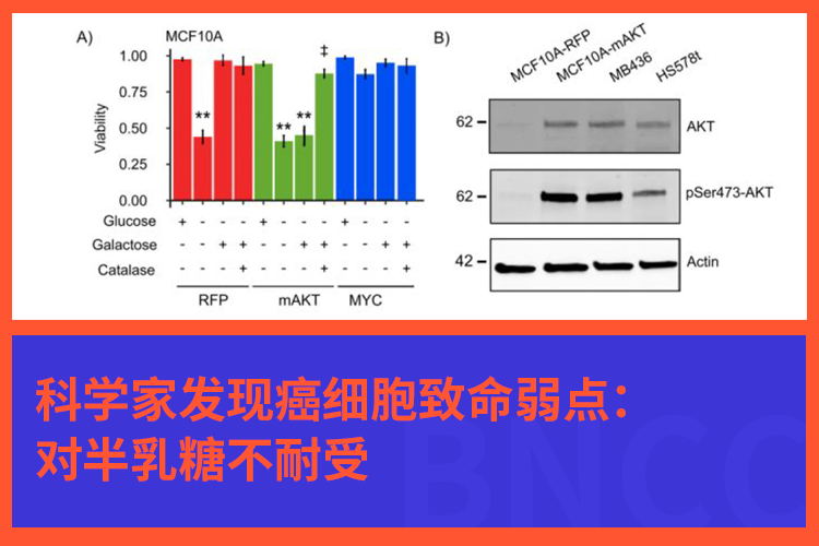 【抑制癌细胞】科学家发现癌细胞致命弱点：对半乳糖不耐受