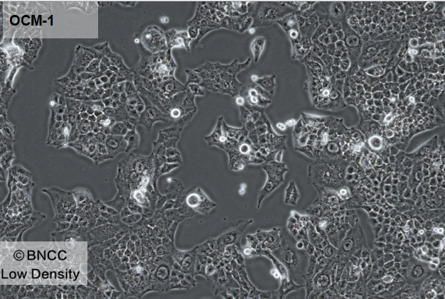 Human intrahepatic cholangiocarcinoma cells-BNCC