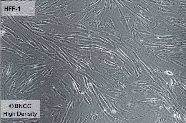 人包皮成纤维细胞-伟业计量