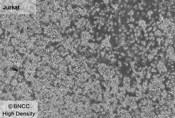 人急性T淋巴细胞白血病细胞-伟业计量