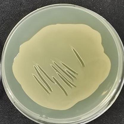 铜绿假单胞菌镜检图片图片