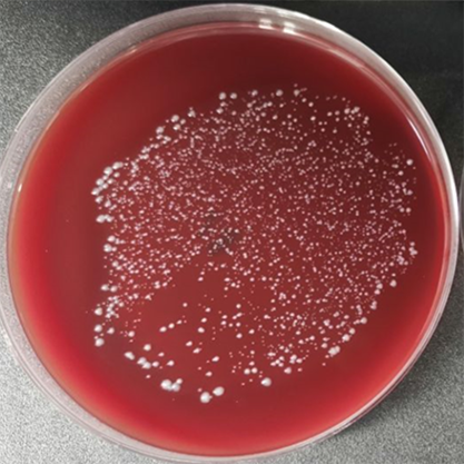 脆弱拟杆菌-北纳生物