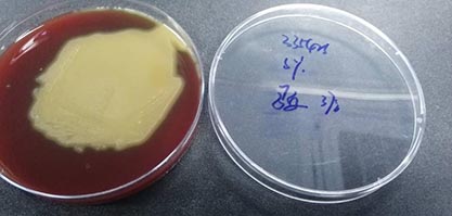 肺炎链球菌-北纳生物