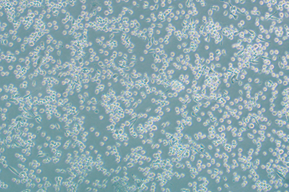 Human well differentiated liposarcoma cells-BNCC