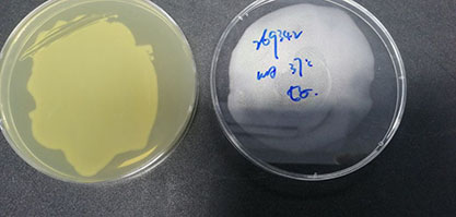 Quantitative strain of Escherichia coli-BNCC