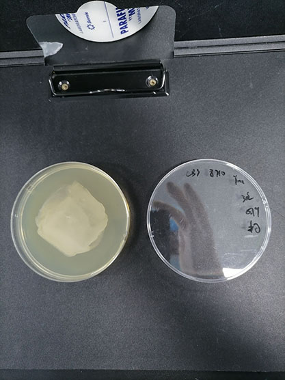 新型隐球酵母