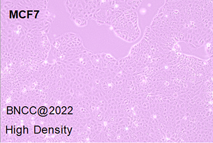 人乳腺癌细胞-北纳生物