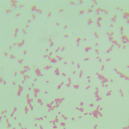 出血性大肠埃希氏菌 O157：H7-北纳生物