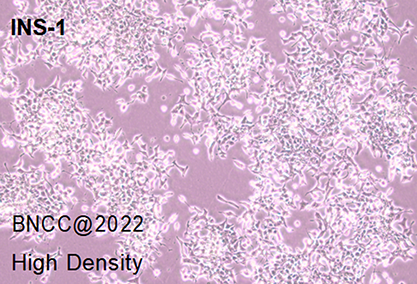 大鼠胰岛细胞瘤细胞-北纳生物