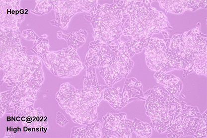 人肝癌细胞-北纳生物