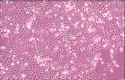 人舌鳞状癌细胞-北纳生物