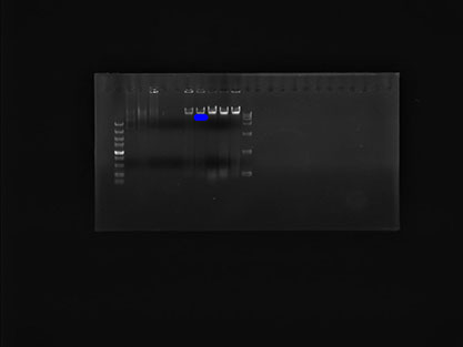 肺炎克雷伯氏菌基因组DNA