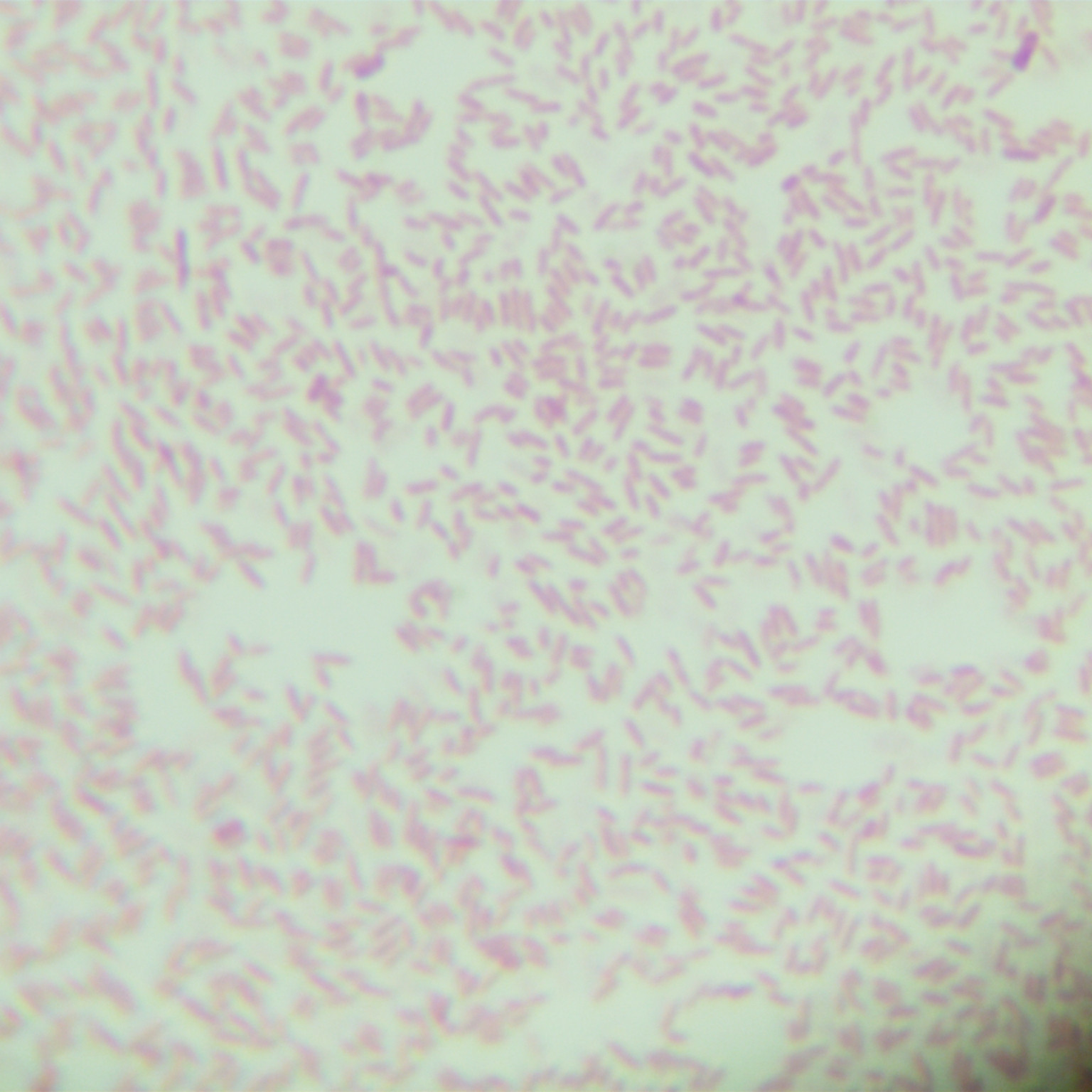 阪崎克洛诺斯杆菌-伟业计量