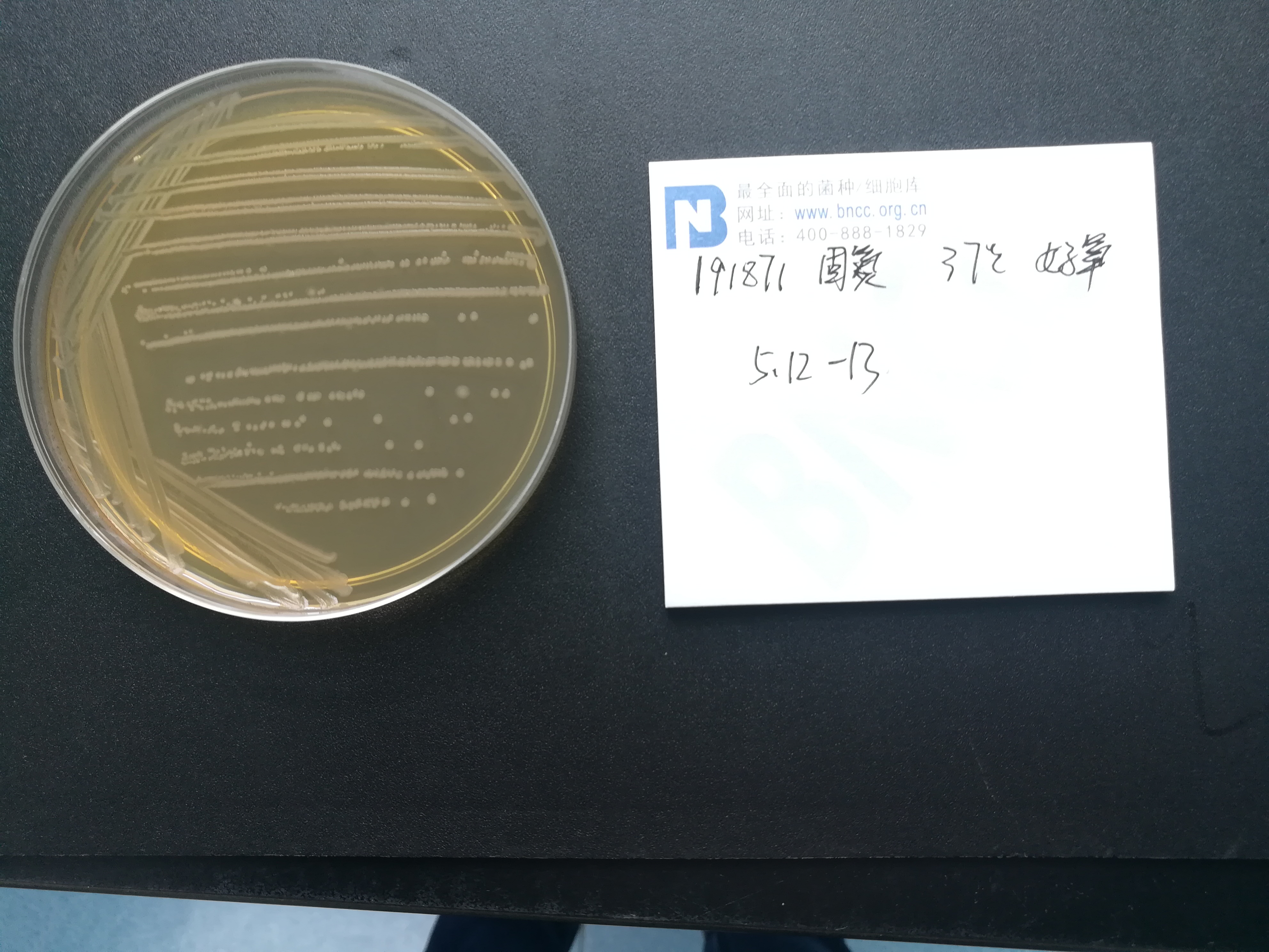 解淀粉芽孢杆菌解淀粉亚种-伟业计量