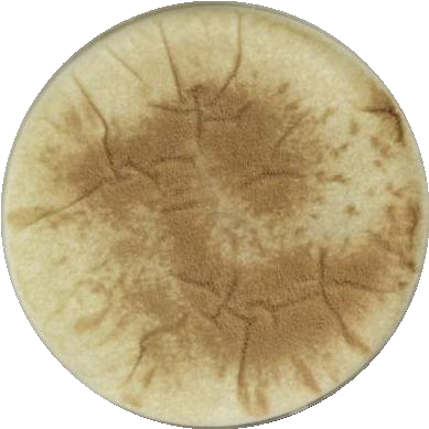 棘孢曲霉-伟业计量