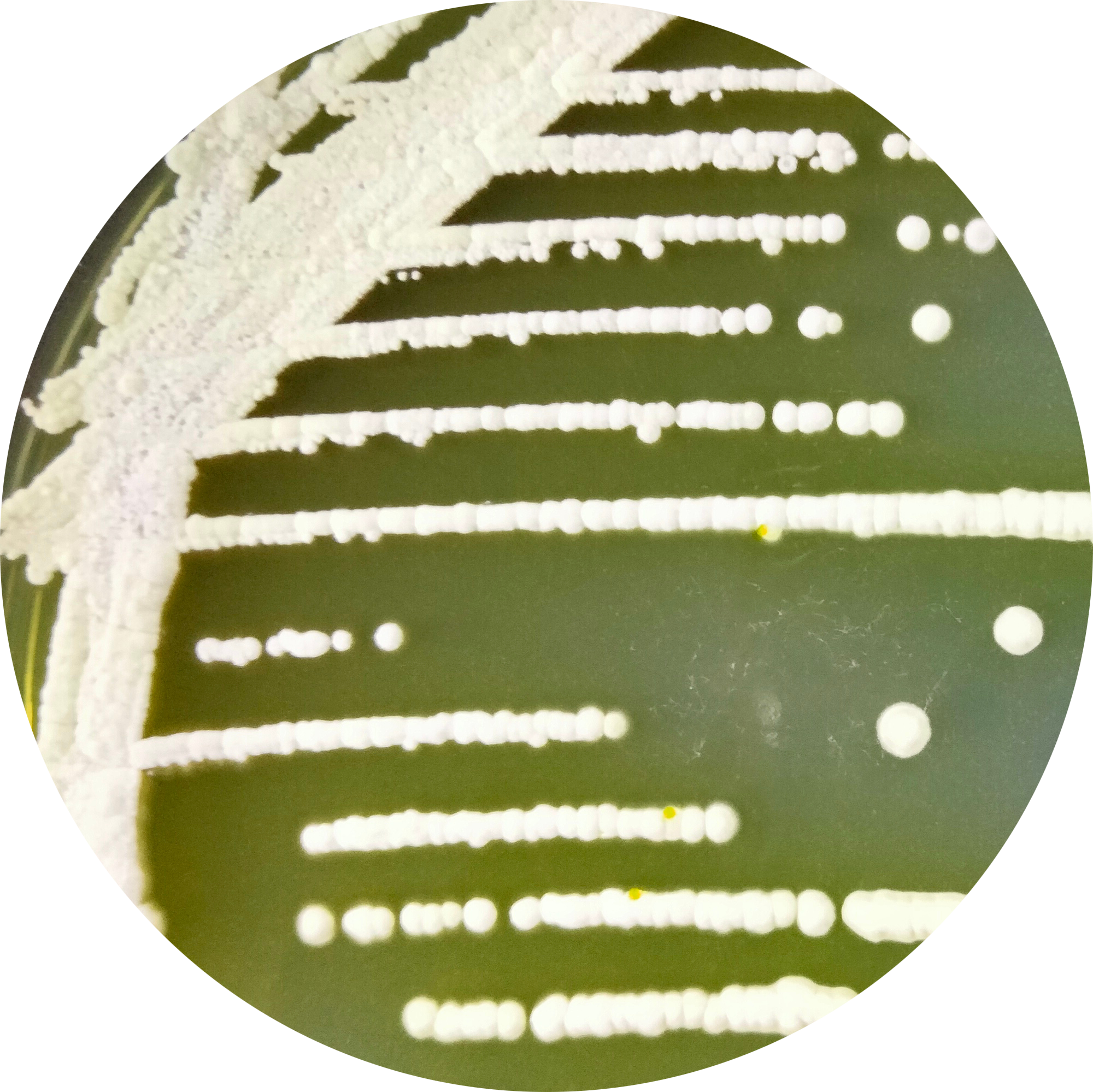 Streptomyces threomyceticus-伟业计量