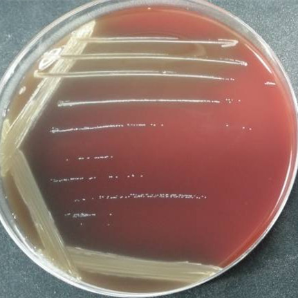 中间链球菌 VPI 3372A [1877, SK 54]-伟业计量