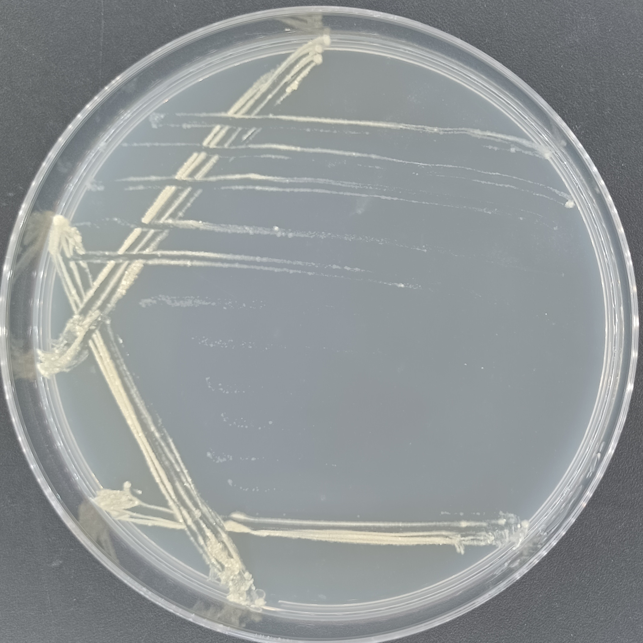 海分枝杆菌-伟业计量