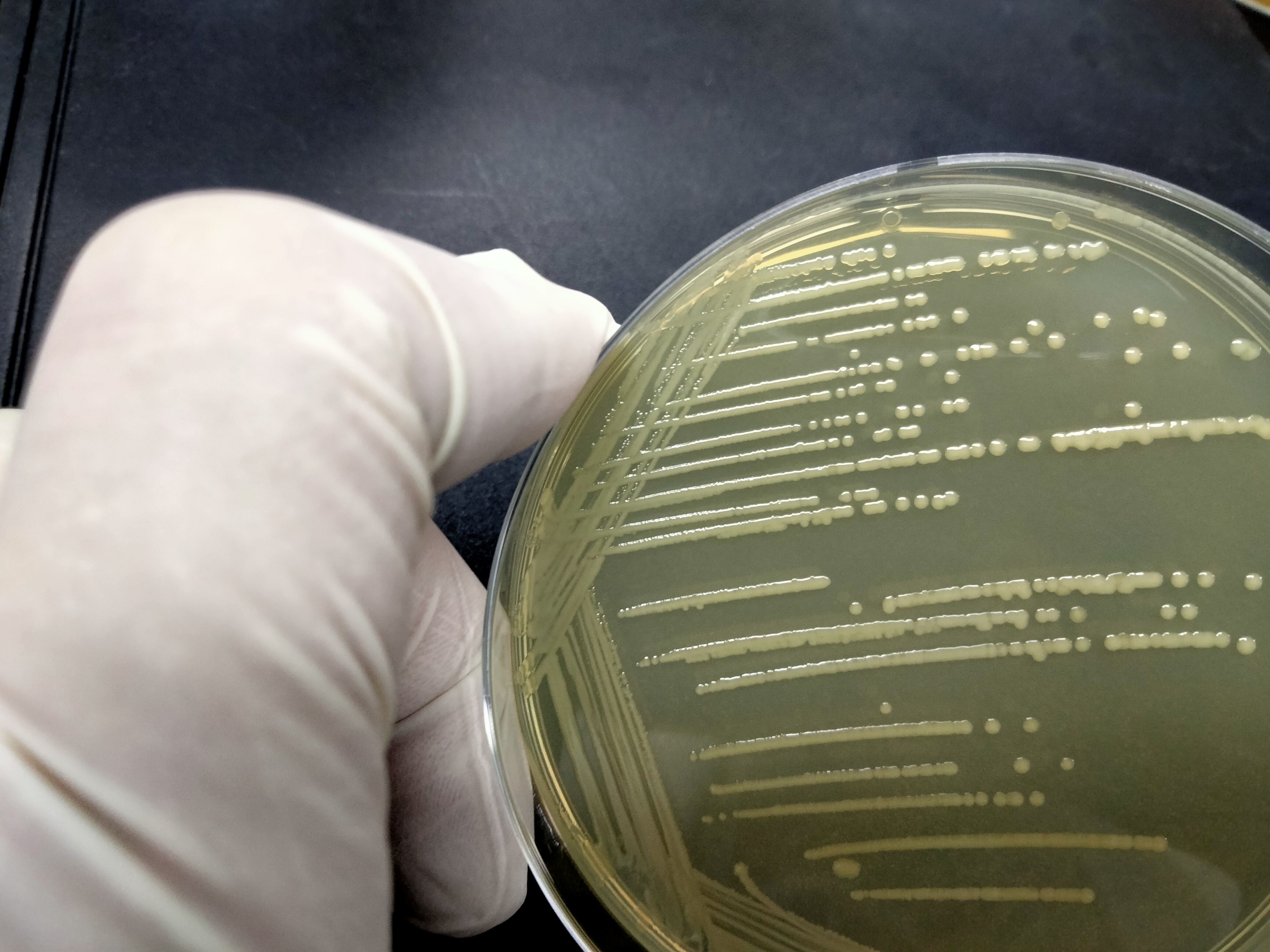 Acinetobacter portensis-伟业计量