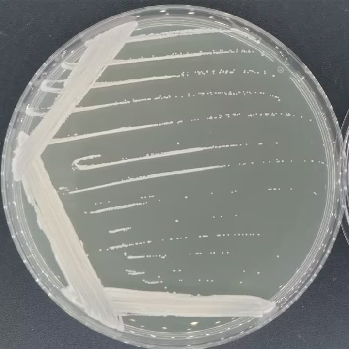 新型隐球菌-伟业计量