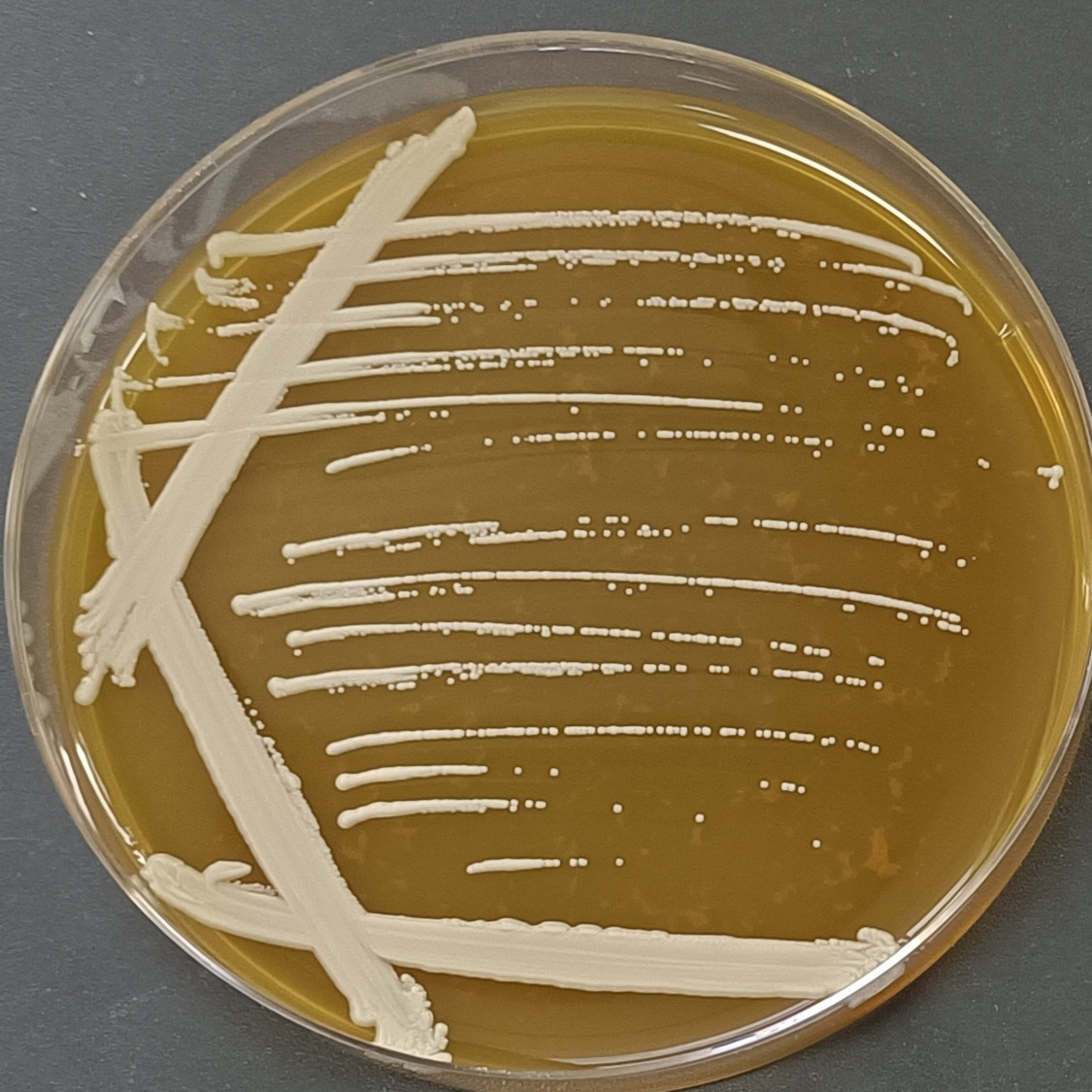 Wickerhamiella versatilis-伟业计量
