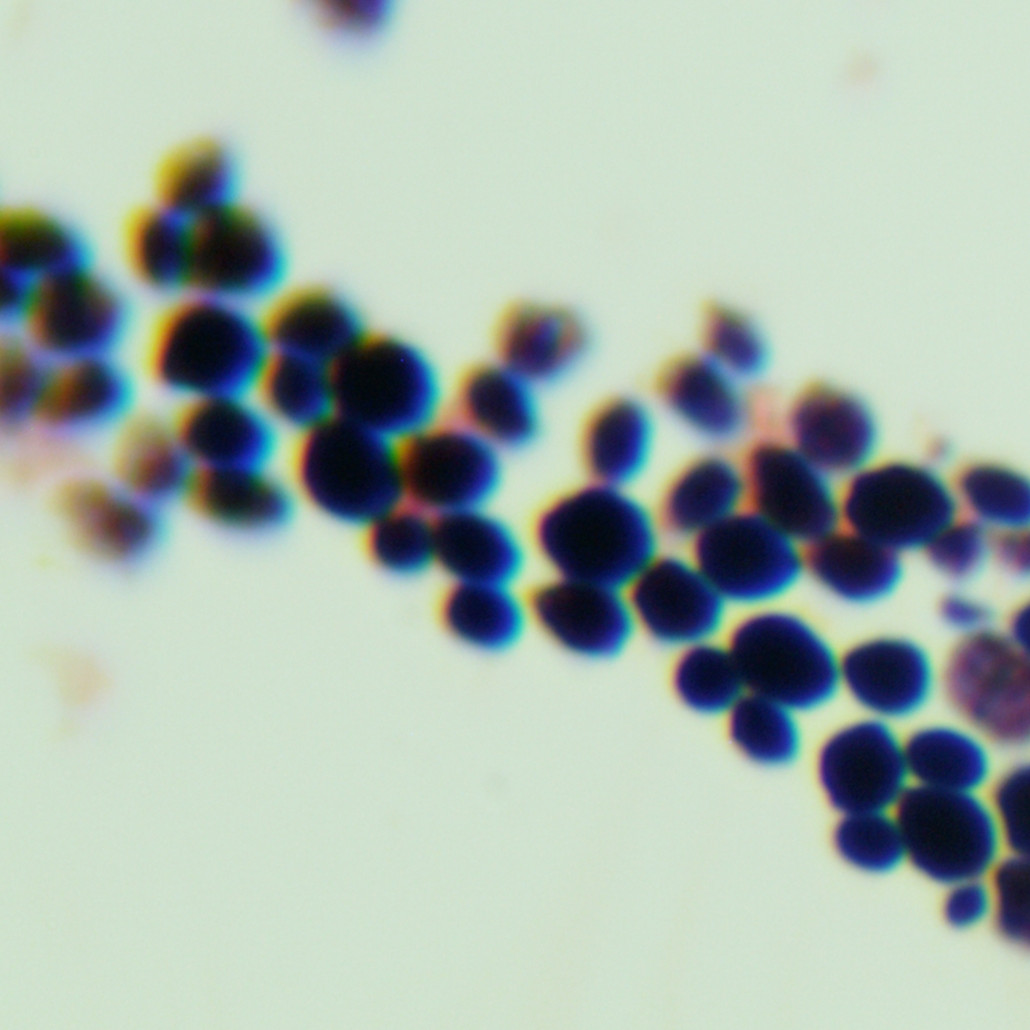 Wickerhamiella versatilis-伟业计量
