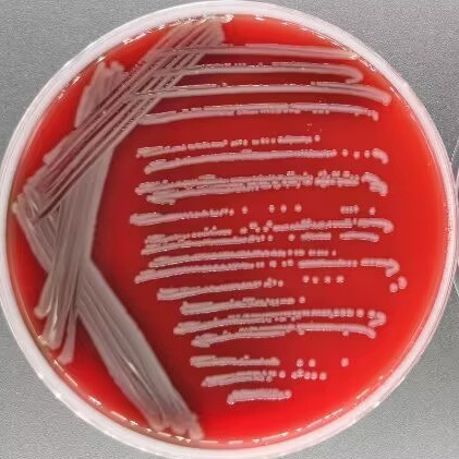 Acinetobacter kanungonis-伟业计量