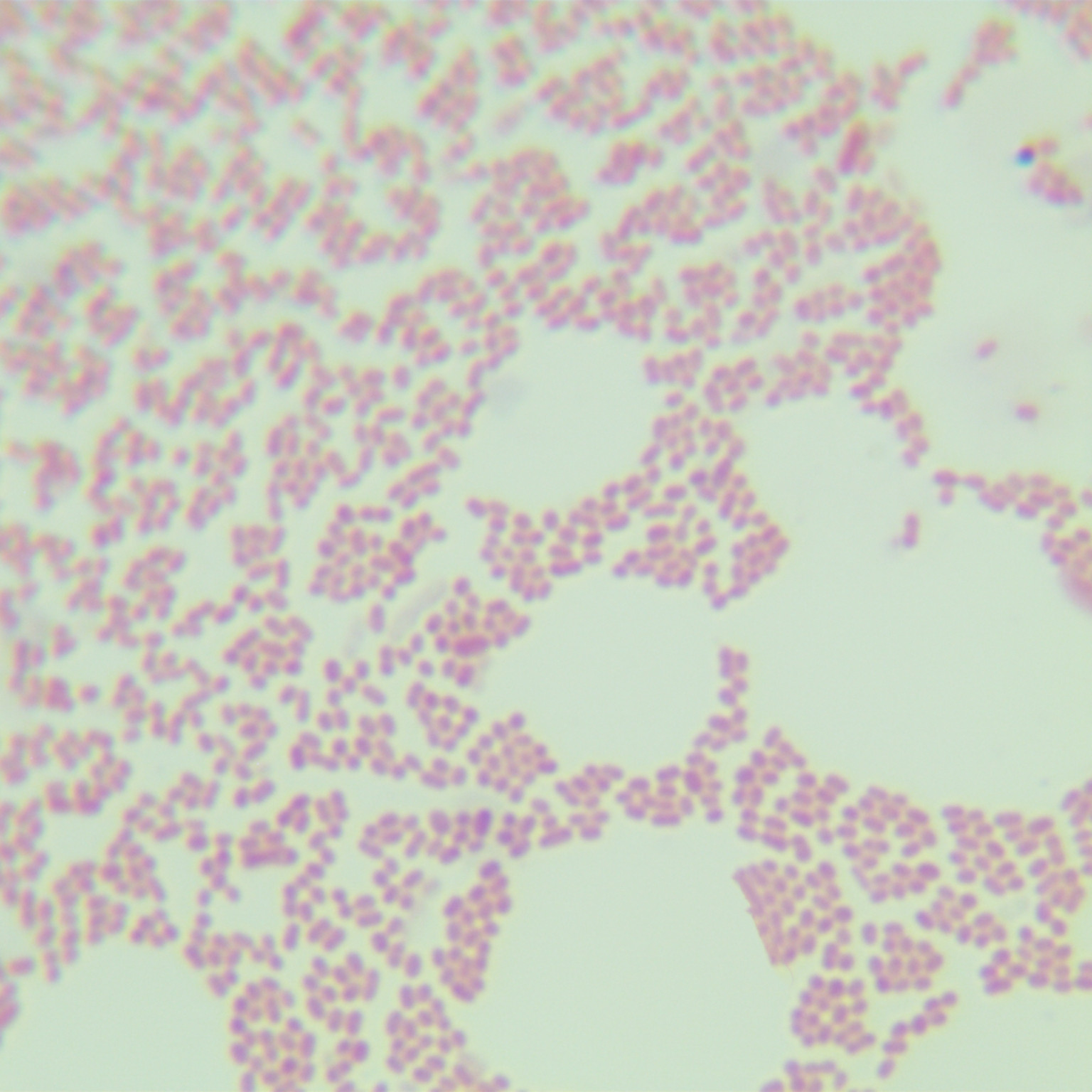 Acinetobacter kanungonis-伟业计量