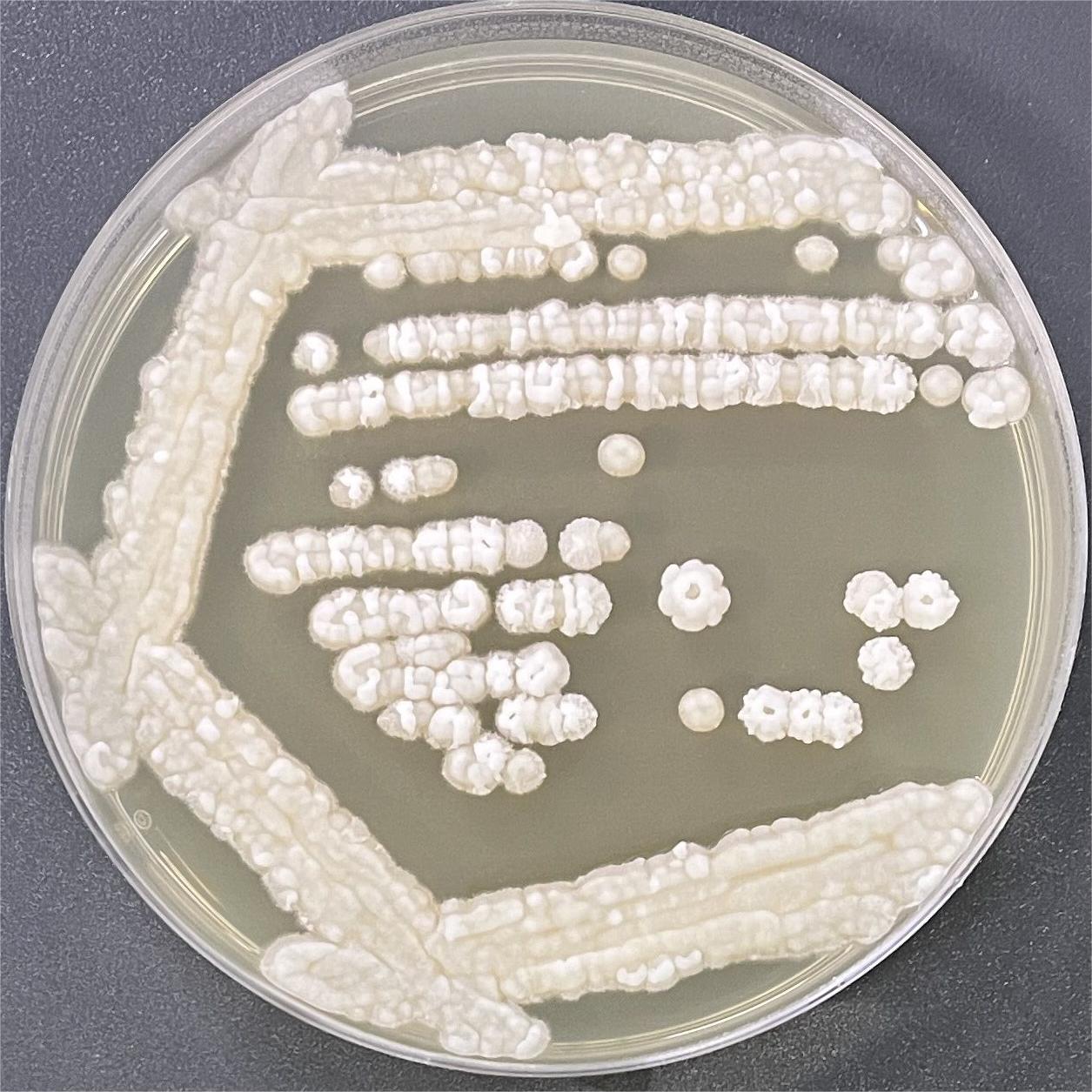 Geotrichum capitatum-伟业计量