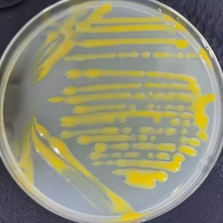噬几丁质菌属-伟业计量