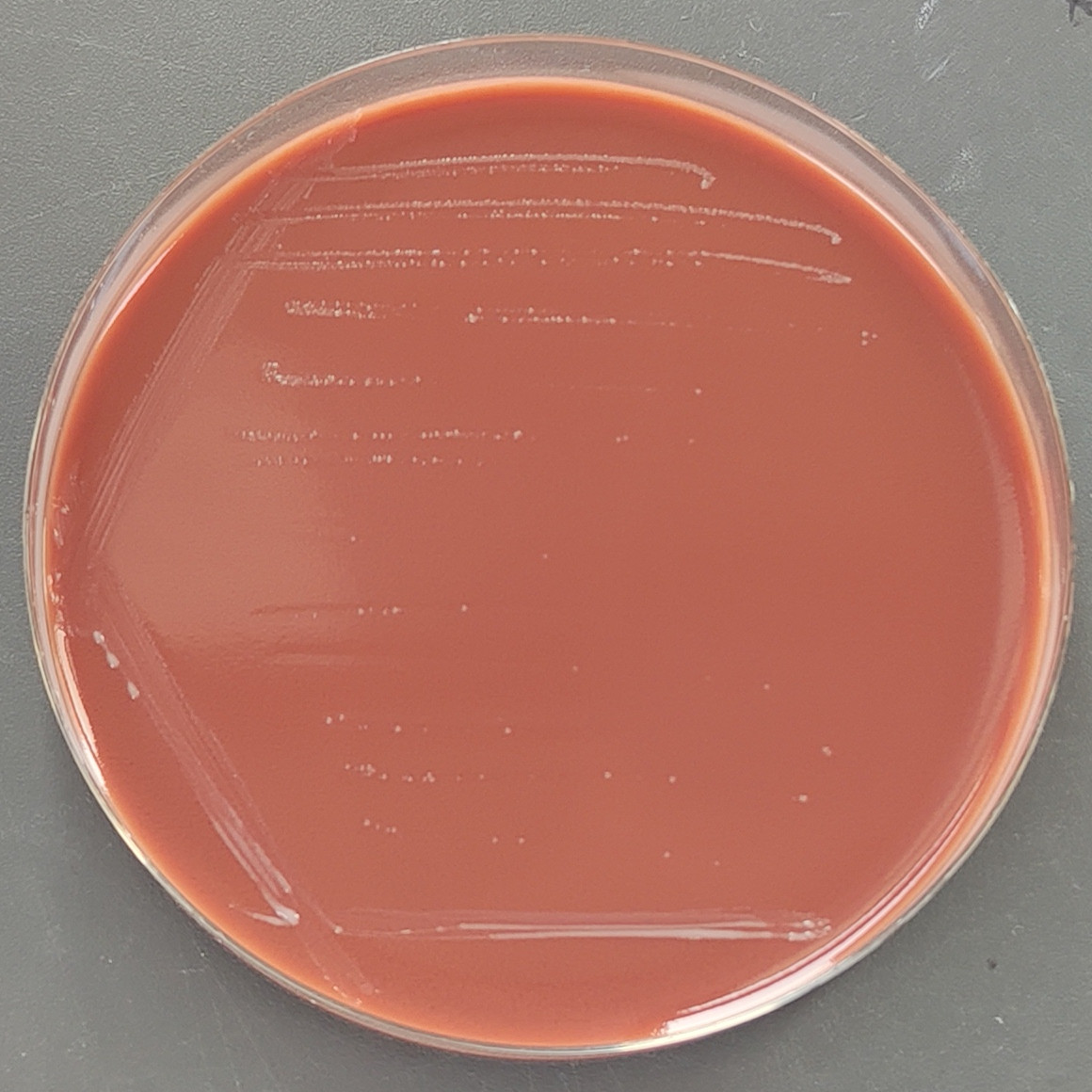 Hoylesella timonensis-伟业计量