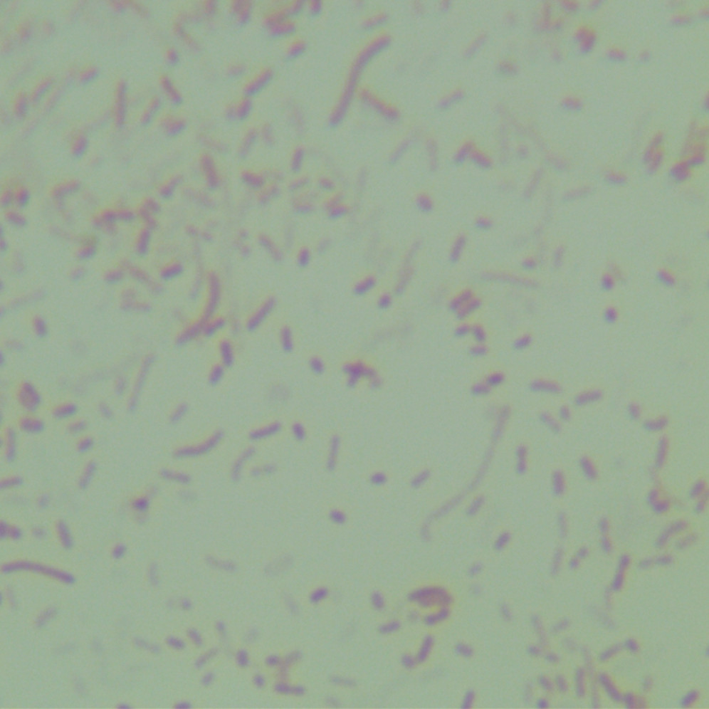 Hoylesella timonensis-伟业计量