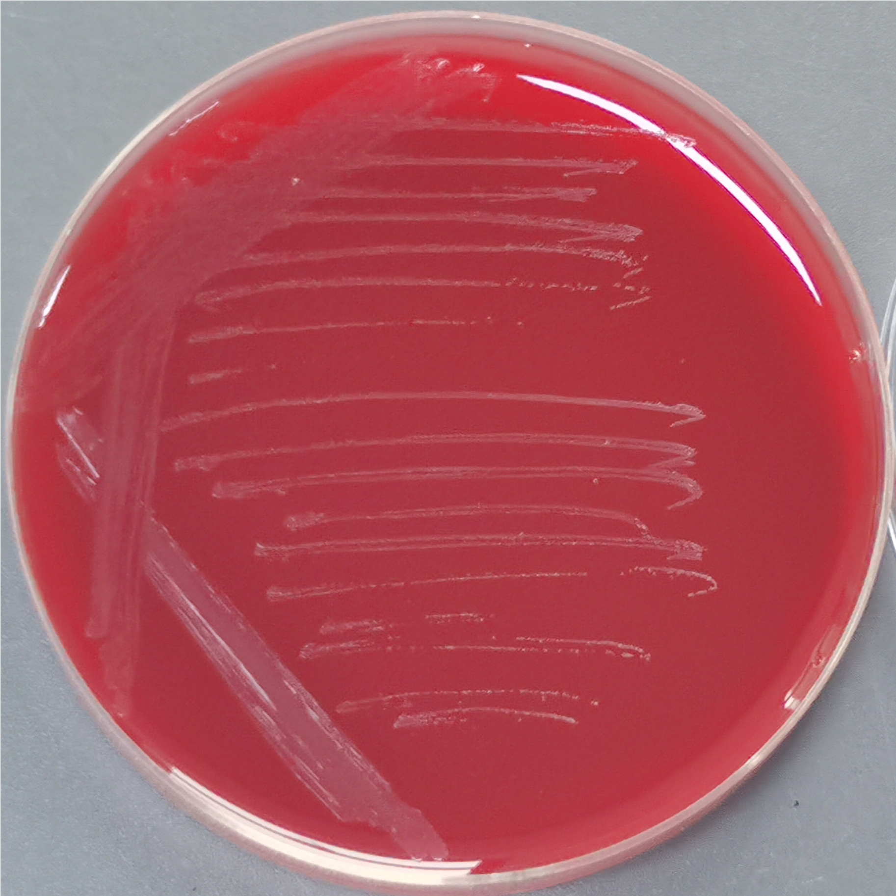 Christensenella hongkongensis-伟业计量