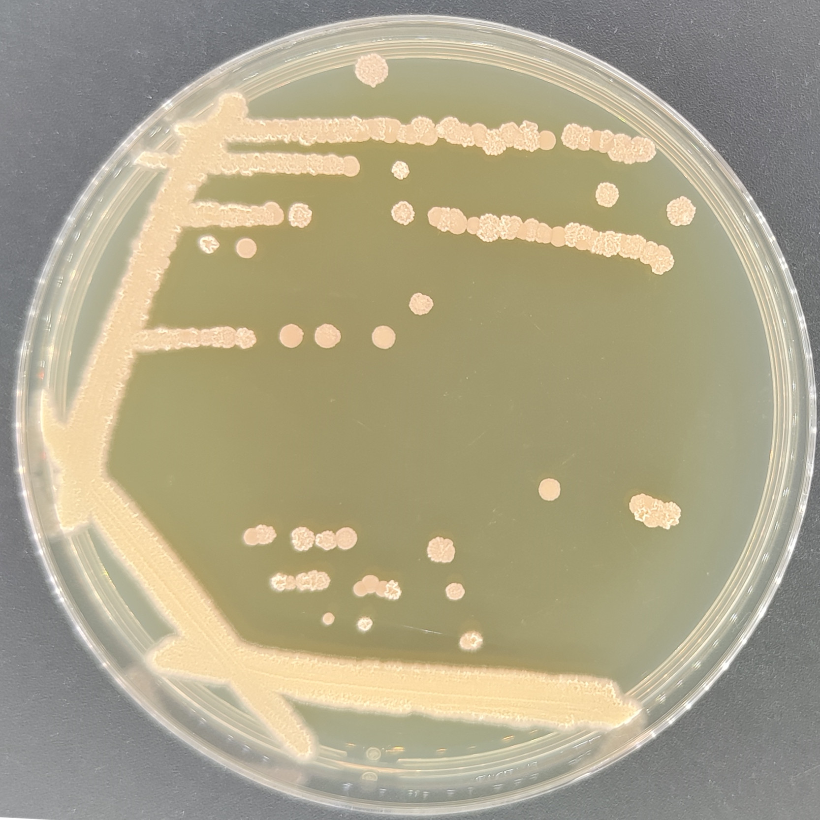 Moesziomyces bullatus-伟业计量