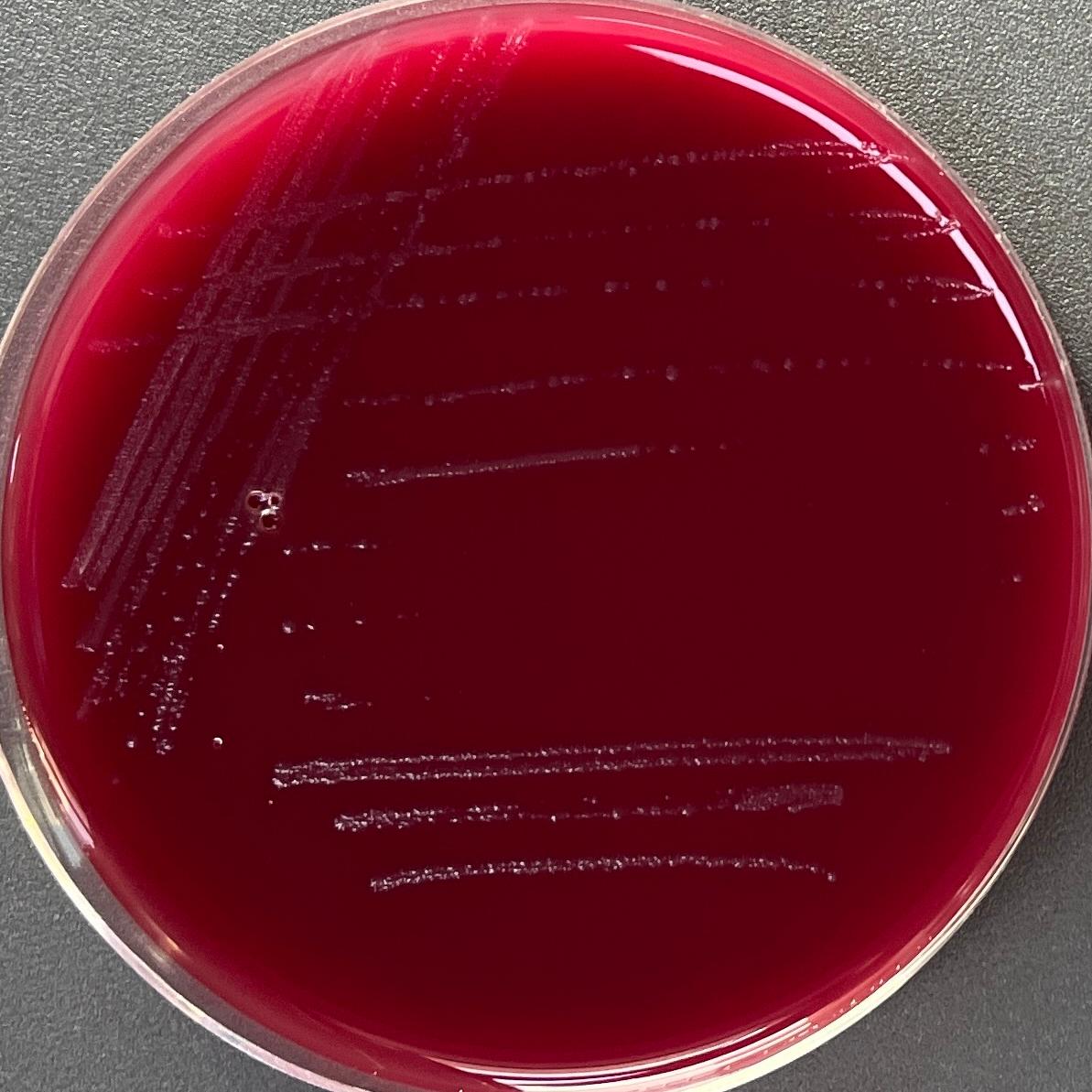 Clostridium massiliodielmoense-伟业计量