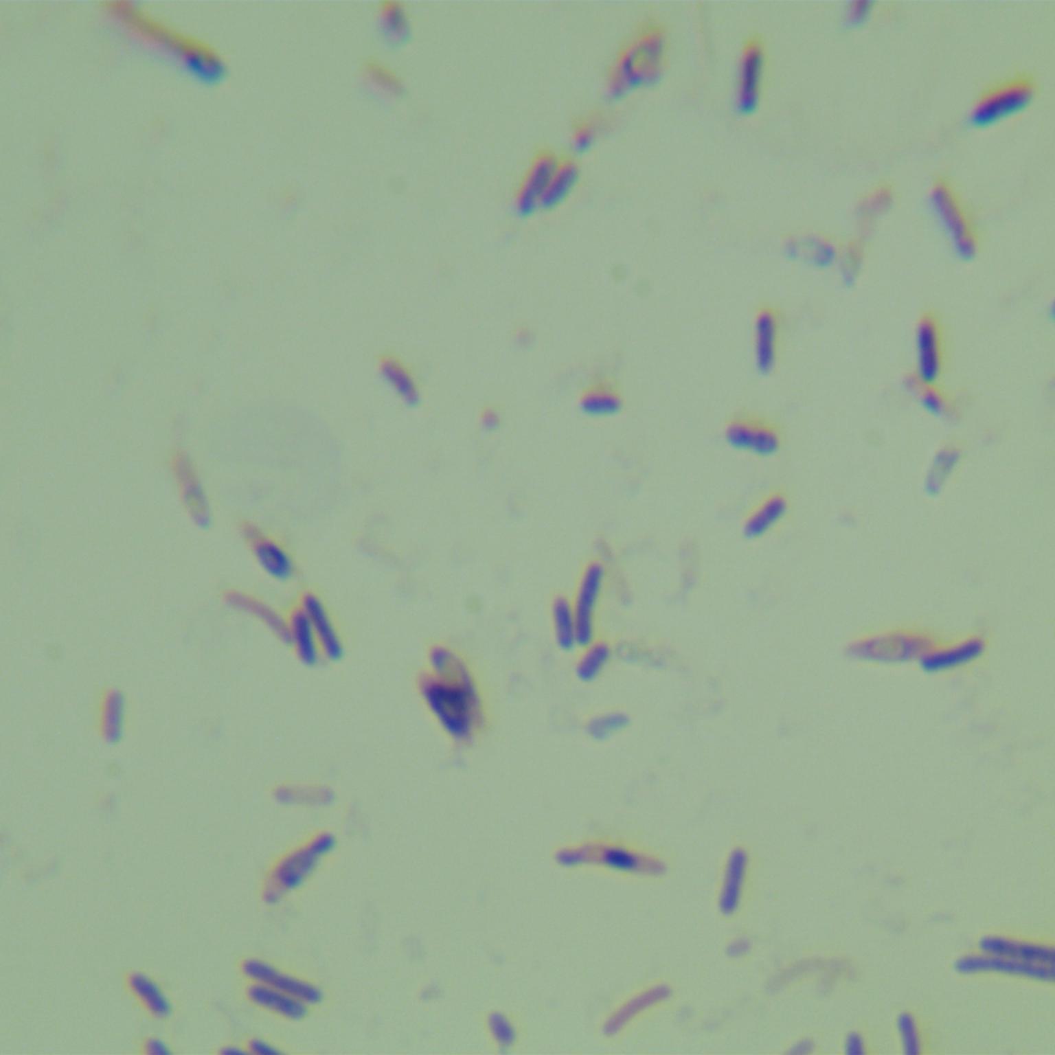 Clostridium massiliodielmoense-伟业计量