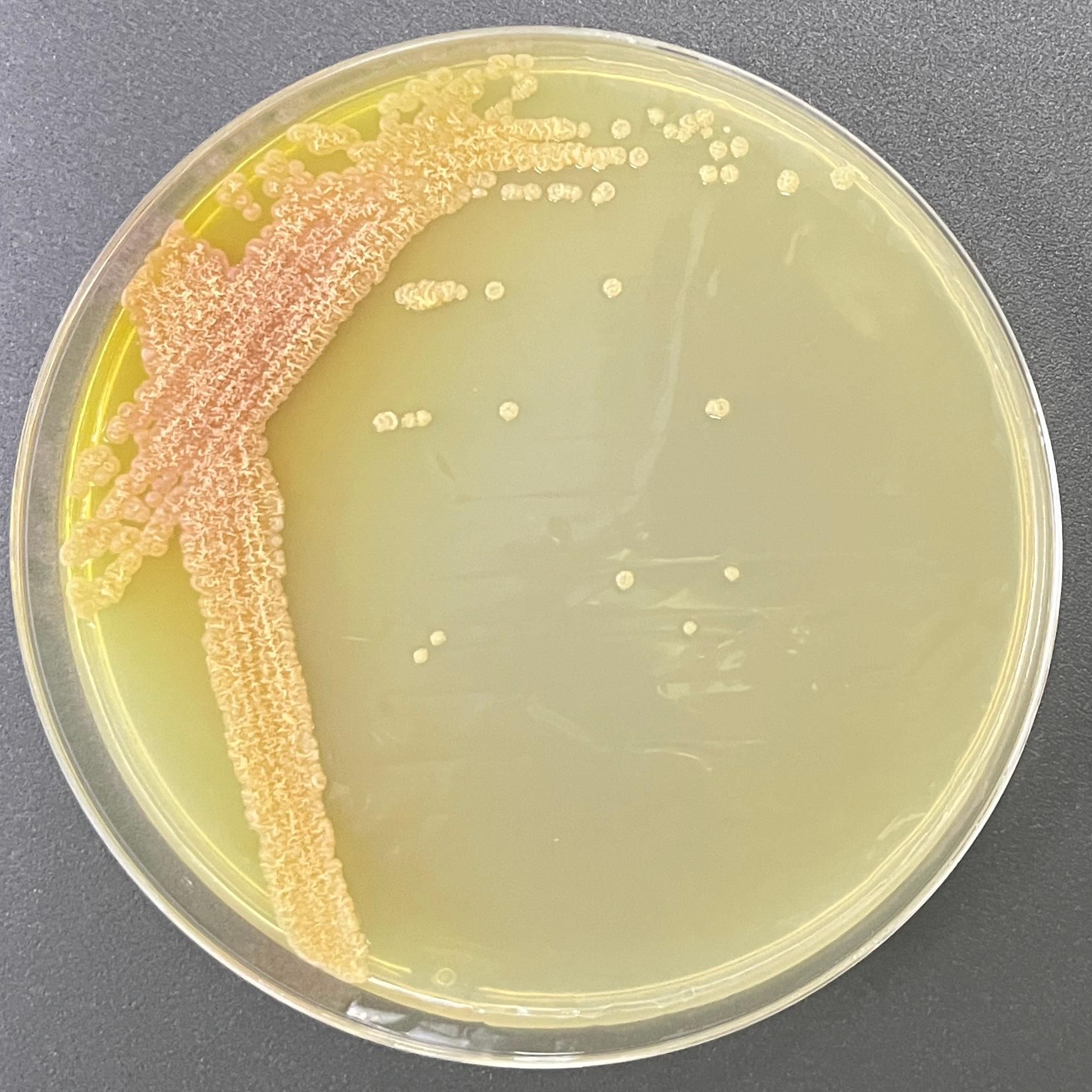 Streptomyces peucetius subsp. caesius Arcamone et al.-伟业计量