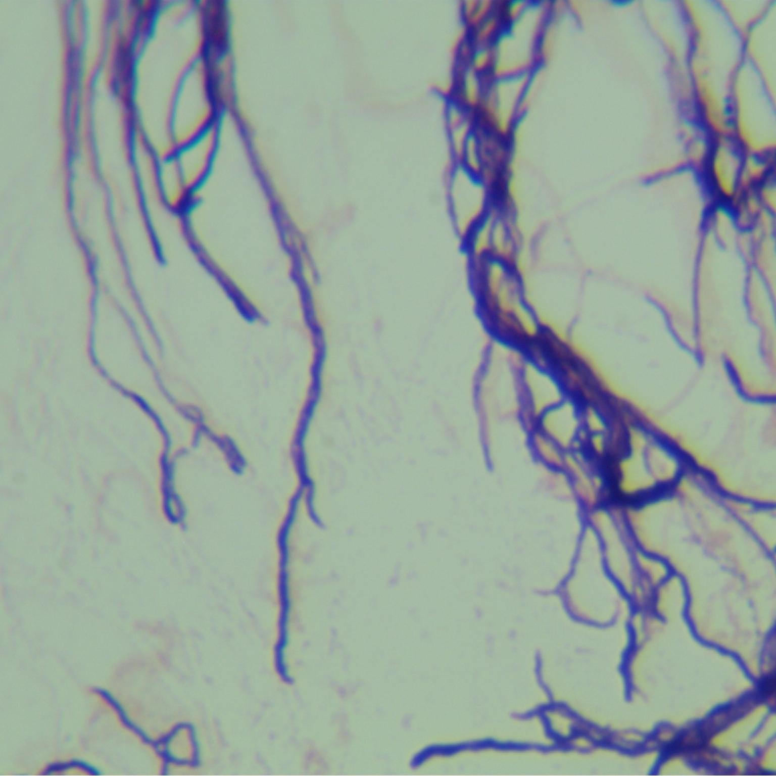 Streptomyces peucetius subsp. caesius Arcamone et al.-伟业计量