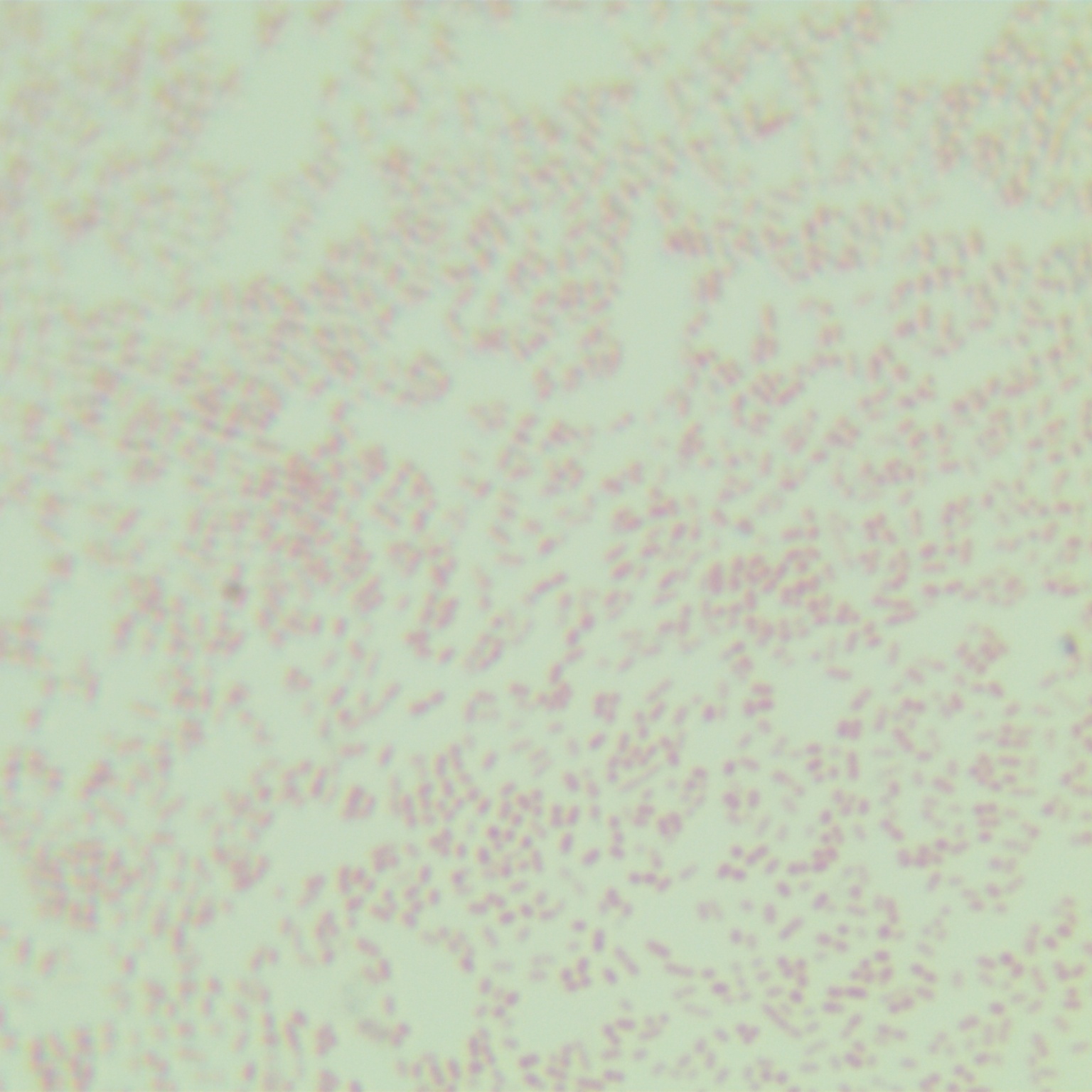 Hoylesella oralis-伟业计量
