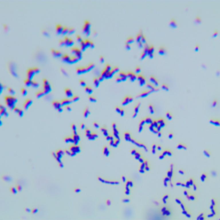 Nocardia noduli-伟业计量
