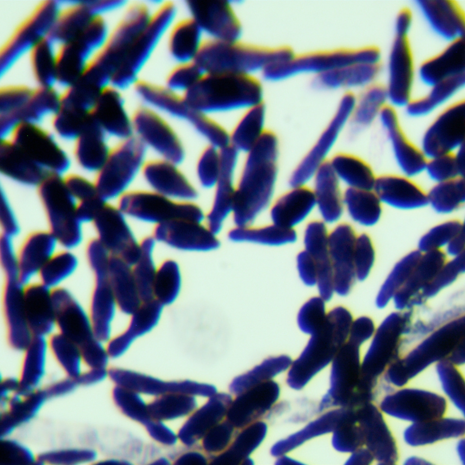 Apiotrichum montevideense-伟业计量