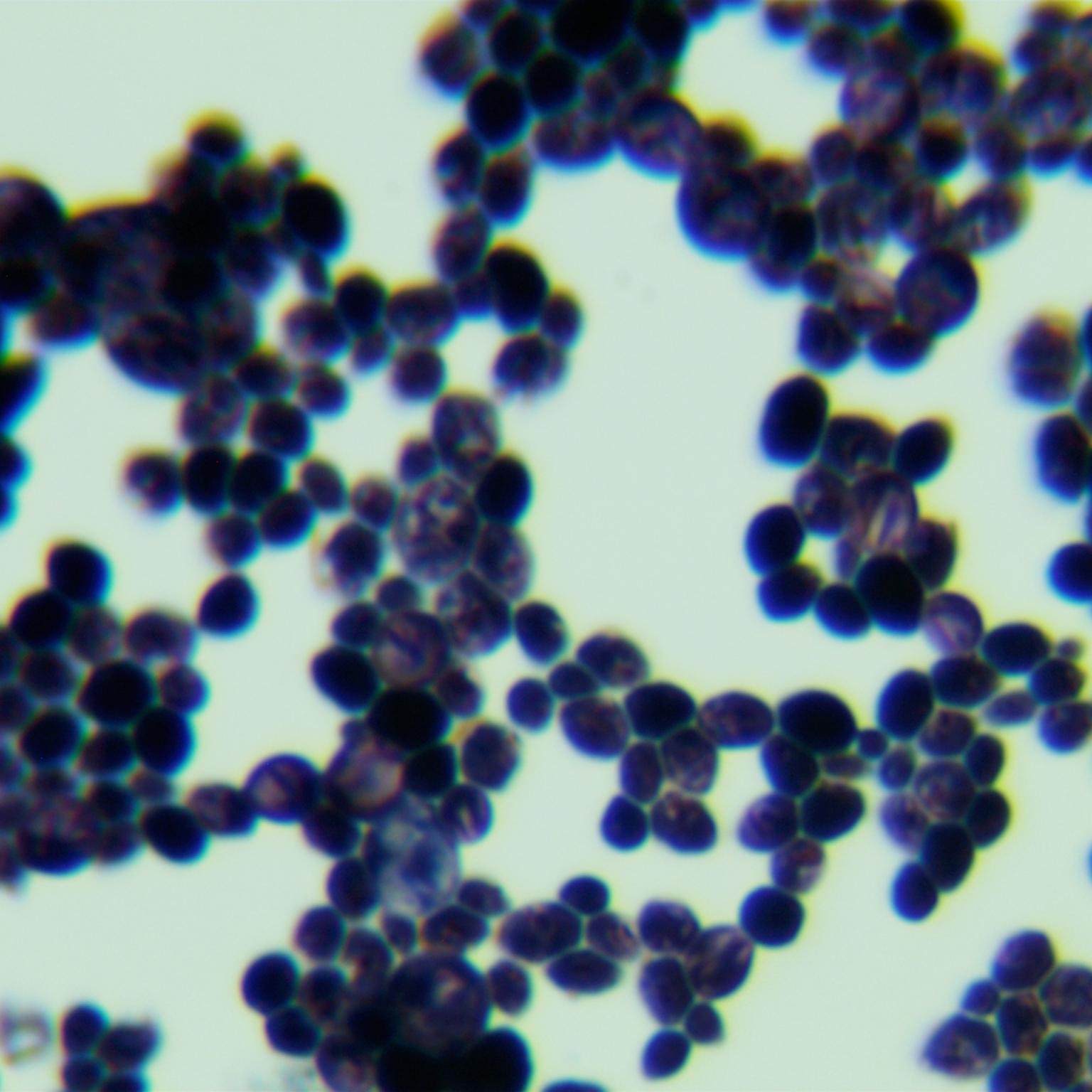 Wickerhamomyces edaphicus-伟业计量