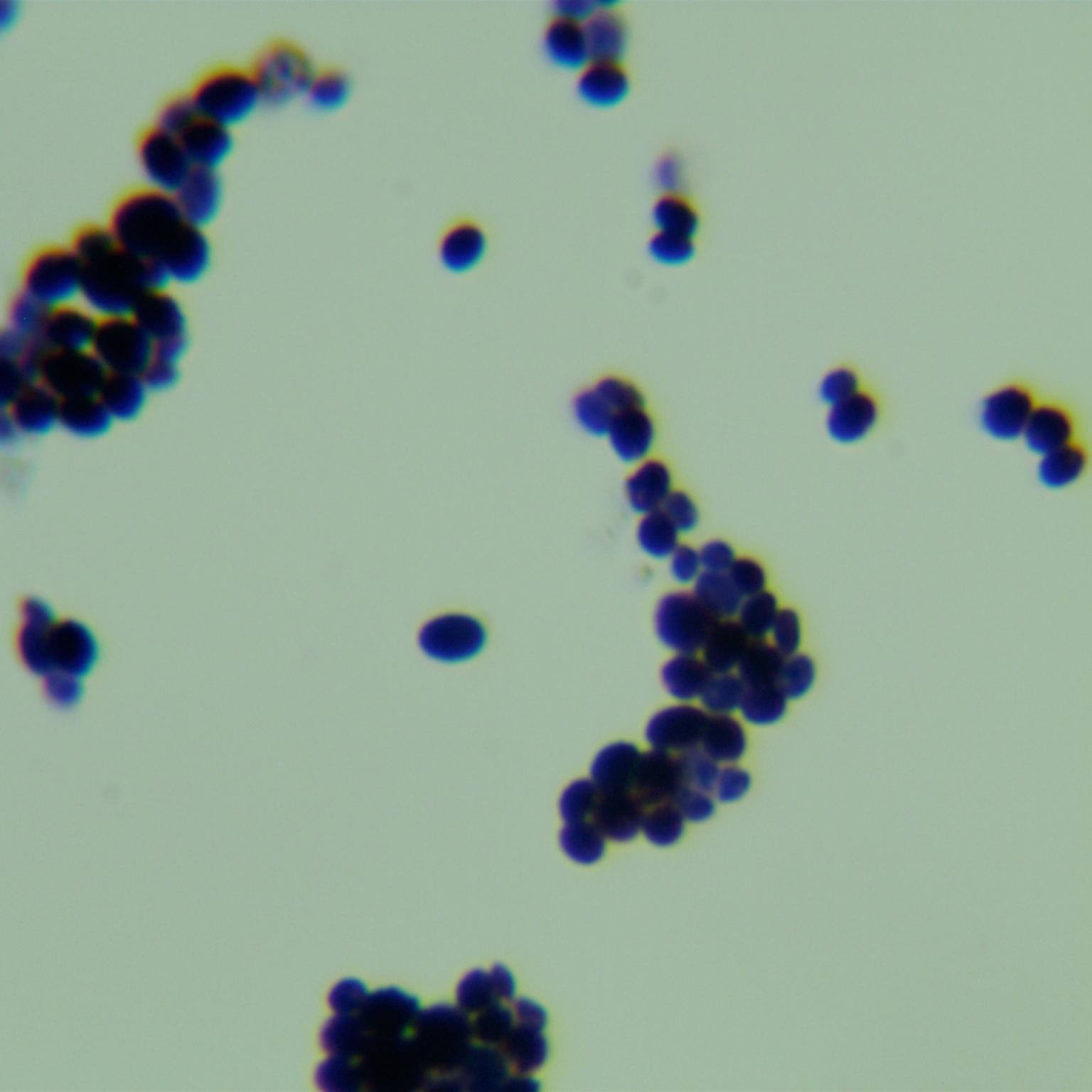 Candida stauntonica-伟业计量